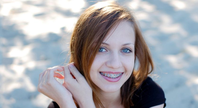 Do Braces Leave Permanent Stains on Teeth? Here’s What You Need to Know