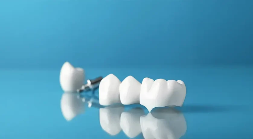 What Are the Signs You Need a Dental Crown Instead of a Filling?